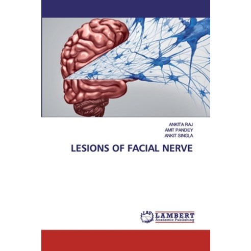 Lesions of Facial Nerve Paperback, LAP Lambert Academic Publishing