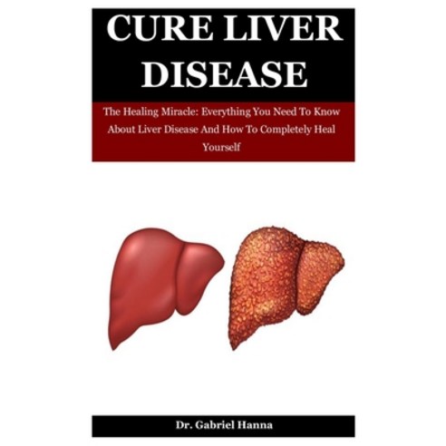 Cure Liver Disease: The Healing Miracle: Everything You Need To Know About Liver Disease And How To ... Paperback, Independently Published, English, 9798555212344