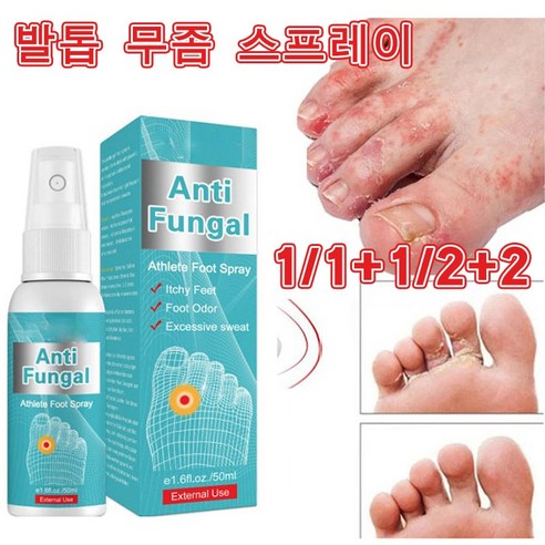 [국내배송 1/1+1/2+2] 발톱 무좀 스프레이 발가락 간지러움 발냄새 제거 연고, 1개, 50ml