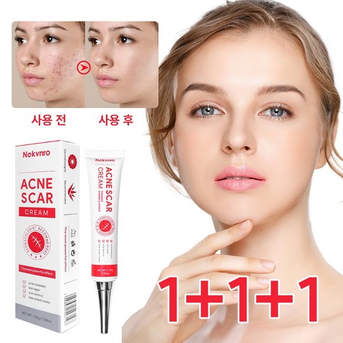 재생크림 여드름리페어연고 색소침착 여드름흉터 수술흉터 피지케어크림, 2개, 30g