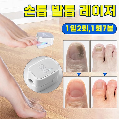 [미국 기술] 손톱 발톱 레이저 문제성 네일 치료기 곰팡이 제거 풋케어, 1개, 화이트