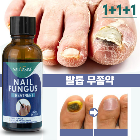 [국내출하] SAUVASINE 발톱무좀 발톱무좀 무좀 조갑사상균증 발톱 관리 손톱 영양제 천연 성분 안전하고 자극이 없다, 30ml, 3개