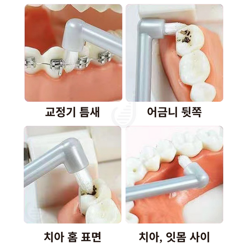 덴탈스마일 어금니 틈새 칫솔, 꼼꼼한 틈새 청결과 잇몸 건강을 위한 완벽한 선택!