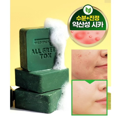 메디픽미 올그린톡스 솔루션 매직 클렌징바, 90g, 2개입