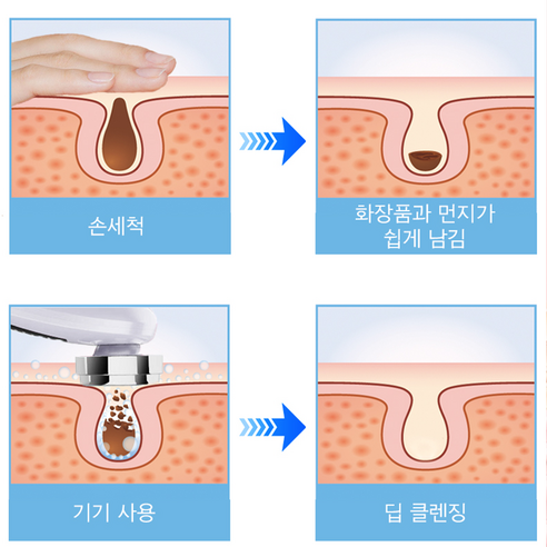 빛나는 피부를 위한 홈 뷰티 솔루션, ERAN스타 갈바닉 마사지기