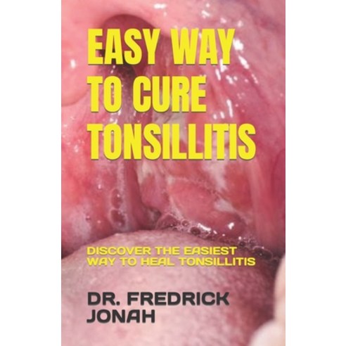 (영문도서) Easy Way to Cure Tonsillitis: Discover the Easiest Way to Heal Tonsillitis Paperback, Independently Published, English, 9798376550007