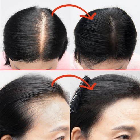 감쪽같은 헤어라인 변신, 노비어 두피 타투 흑채로 자신감을 되찾으세요!