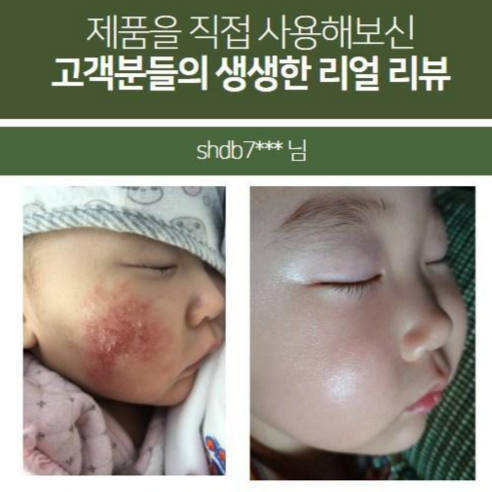 약쑥과 어성초가 조화롭게 어우러진 모낭 청소와 피부 진정을 위한 최적의 선택