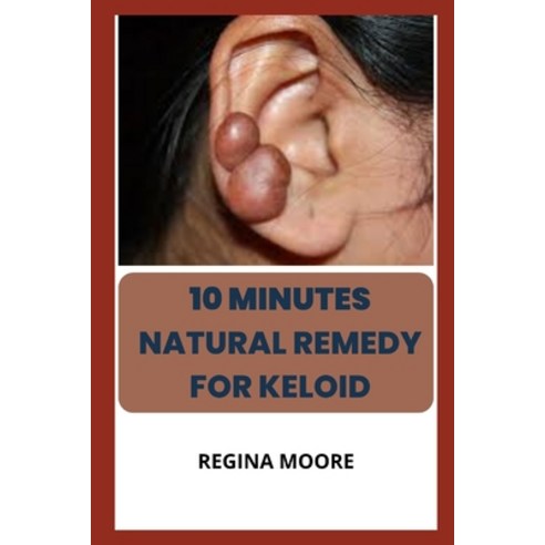 (영문도서) 10 minutes natural remedy for Keloids Paperback, Independently Published, English, 9798849594781