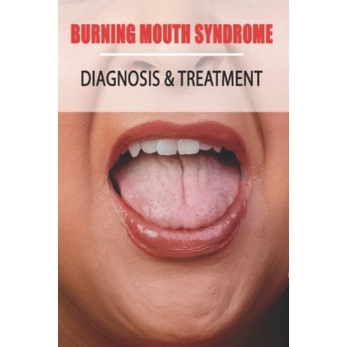 Burning Mouth Syndrome: Diagnosis & Treatment: Burning Mouth Syndrome Guide Paperback, Independently Published, English, 9798709025448