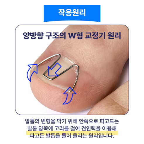 내성발톱 고통, 메디아르 교정기로 편안한 일상을 되찾으세요!