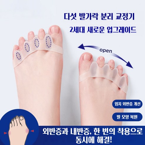 와이피 효과적인 엄지발가락 외반교정 편안한 실리콘 발가락교정기 좌우세트, 1세트