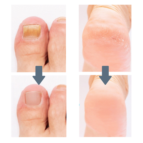 피부 속 숨겨진 광채를 깨우는 비밀, 리디에뜨 리디좀