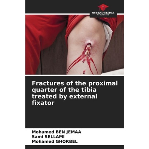 (영문도서) Fractures of the proximal quarter of the tibia treated by external fixator Paperback, Our Knowledge Publishing, English, 9786205898802