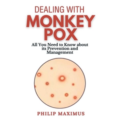 (영문도서) Dealing with MonkeyPox: All You Need to Know about its Prevention and Management Paperback, Independently Published, English, 9798871764497