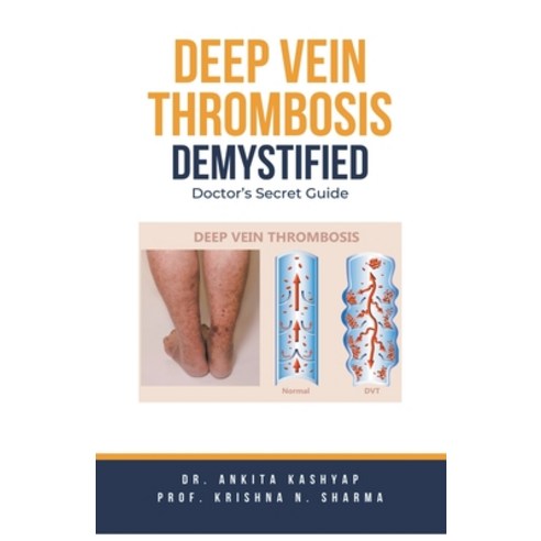 (영문도서) Deep Vein Thrombosis Demystified: Doctor''s Secret Guide Paperback, Virtued Press, English, 9798215220757