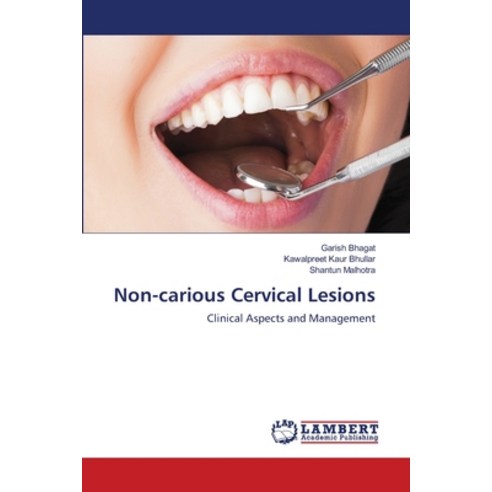 (영문도서) Non-carious Cervical Lesions Paperback, LAP Lambert Academic Publis..., English, 9786203574234