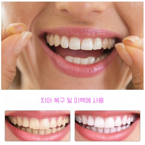 빛나는 미소, 자신감을 되찾아 줄 1+1 틀니 치아미백