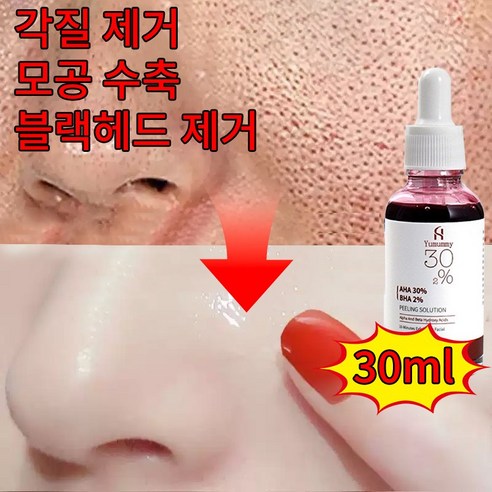 거울 속 딸기코, 더 이상 숨기지 마세요! 매끈 피부 되찾는 솔루션 피지녹이는제품