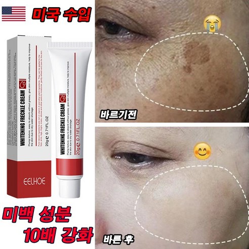 [국내당일출고] 1/1+1 기미 잡티 케어 미백 크림 주근깨 제거 검버섯 기능성 크림 20g/효과보장!!!, 1개(1+1아님!!!)