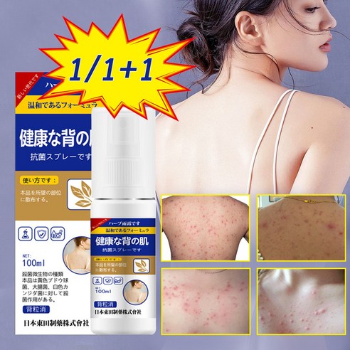 에바스 블루 로즈마인 샤워코롱, 185ml, 2개 미스트 11 KORE LAN 1/1+1 등드름 바디여드름 바디미스트 딥클린 각질케어 등드름개선 가려움증을 빠르게 완화, 1개, 100ml