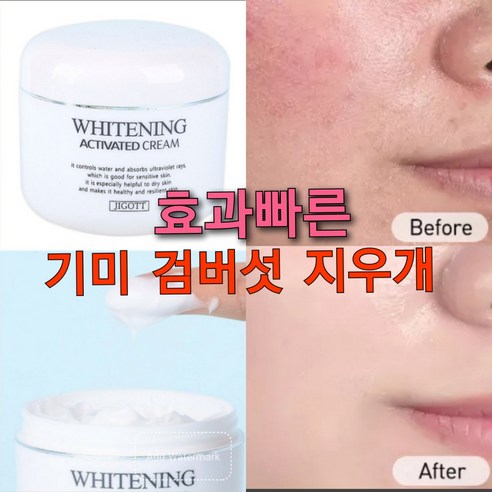 기미 검버섯 화이트닝크림