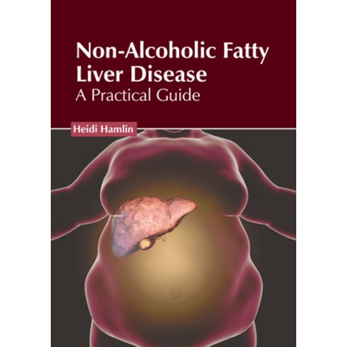 (영문도서) Non-Alcoholic Fatty Liver Disease: A Practical Guide Hardcover, Hayle Medical, English, 9781646475636