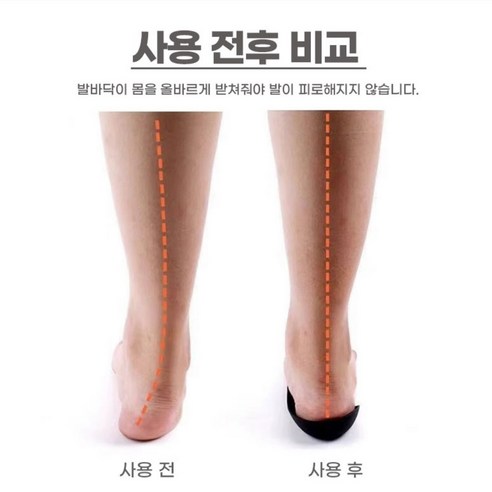 풋닥터 기능성 오다리 발교정깔창 1+1 휜다리 O형 X형 휜다리 평발 근막통증 팔자걸음 안장걸음, 2개, 블랙