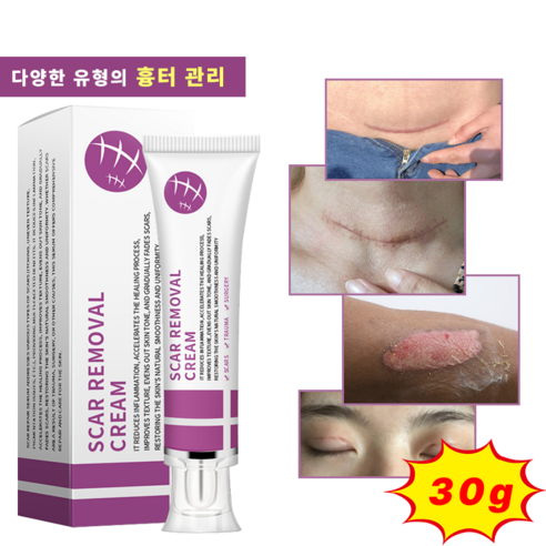 화상연고 상처 연고 켈로이드 욕창 찰과상 피부흉터 흉터 연고, 30ml, 1개