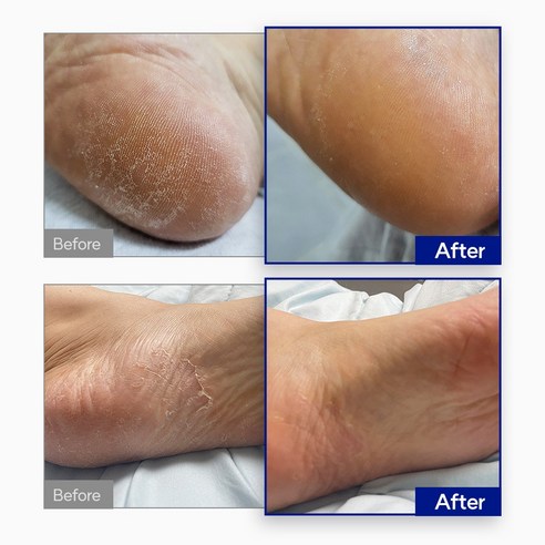 발의 건강과 위생을 챙기는 완벽한 해결책