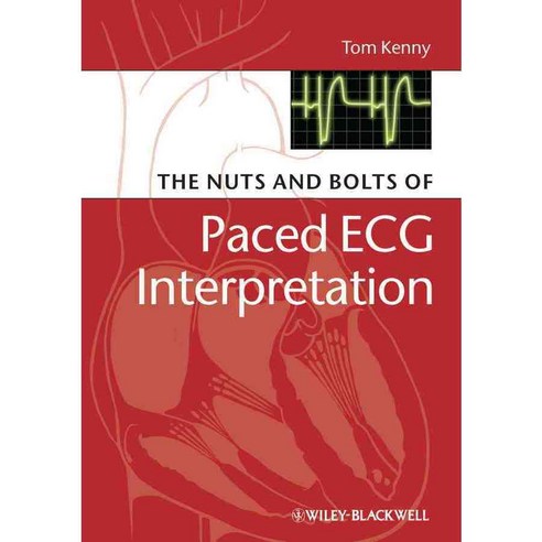 The Nuts and Bolts of Paced ECG Interpretation, Blackwell Pub
