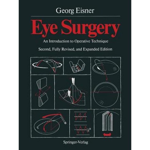 Eye Surgery: An Introduction to Operative Technique Paperback, Springer