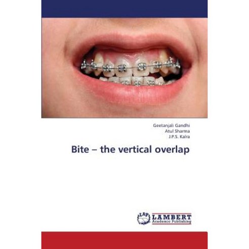 Bite - The Vertical Overlap Paperback, LAP Lambert Academic Publishing