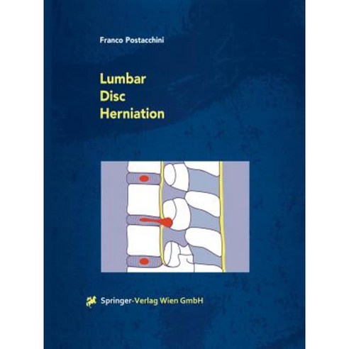 Lumbar Disc Herniation Paperback, Springer