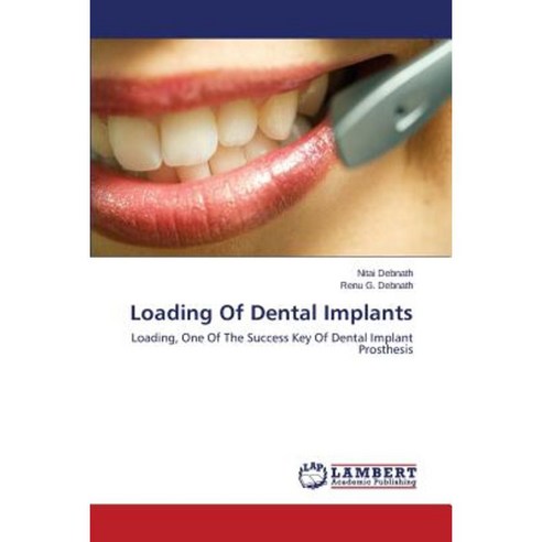 Loading of Dental Implants Paperback, LAP Lambert Academic Publishing
