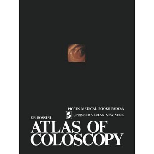 Atlas of Coloscopy Paperback, Springer