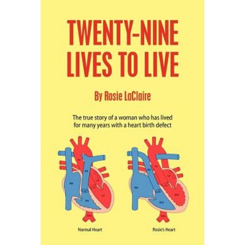 Twenty-Nine Lives to Live Paperback, Createspace Independent Publishing Platform