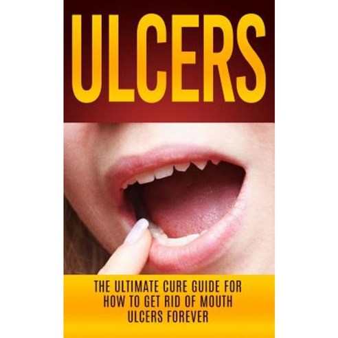 Ulcers: The Ultimate Cure Guide for How to Get Rid of Mouth Ulcers Instantly Paperback, Createspace Independent Publishing Platform