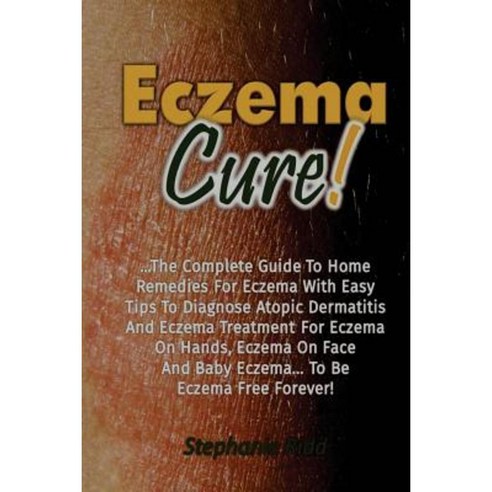 Eczema Cure!: The Complete Guide to Home Remedies for Eczema with Easy Tips to D Paperback, Createspace Independent Publishing Platform