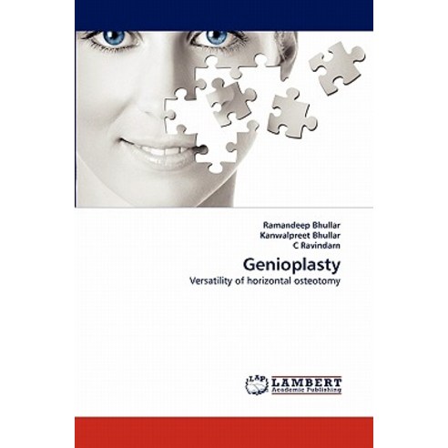 Genioplasty Paperback, LAP Lambert Academic Publishing