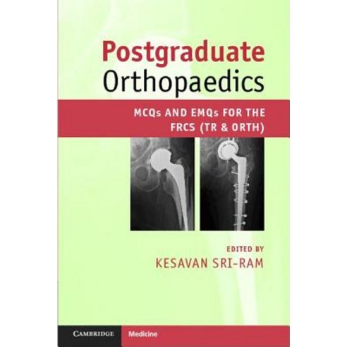 Postgraduate Orthopaedics Paperback, Cambridge University Press