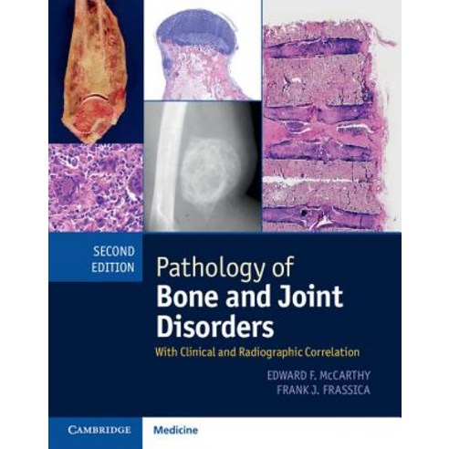 Pathology of Bone and Joint Disorders Print and Online Bundle: With ...