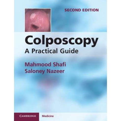Colposcopy: A Practical Guide. Mahmood I. Shafi and Saloney Nazeer Paperback, Cambridge University Press