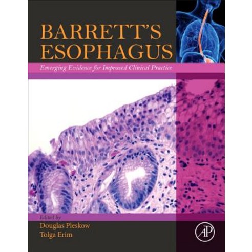Barrett''s Esophagus: Emerging Evidence for Improved Clinical Practice Paperback, Academic Press