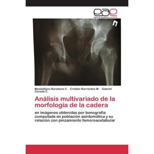 Analisis Multivariado de La Morfologia de La Cadera, Editorial Academica Espanola