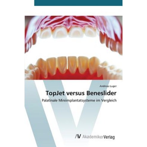 Topjet Versus Beneslider, AV Akademikerverlag