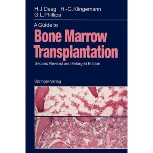 A Guide to Bone Marrow Transplantation Paperback, Springer