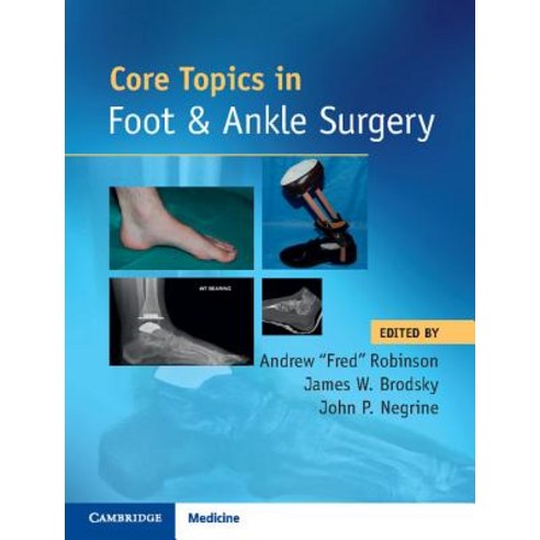 Core Topics in Foot and Ankle Surgery Hardcover, Cambridge University Press