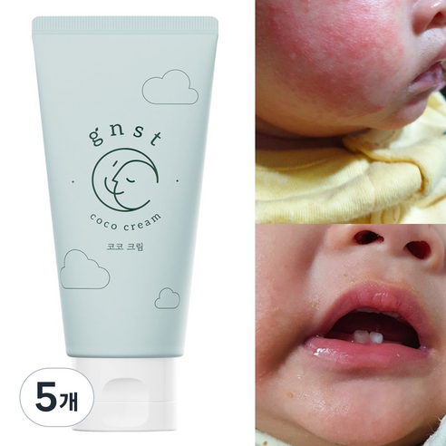 GNST 지엔에스티 코코 크림 침독크림 아기로션 유아로션 신생아, 80ml, 5개