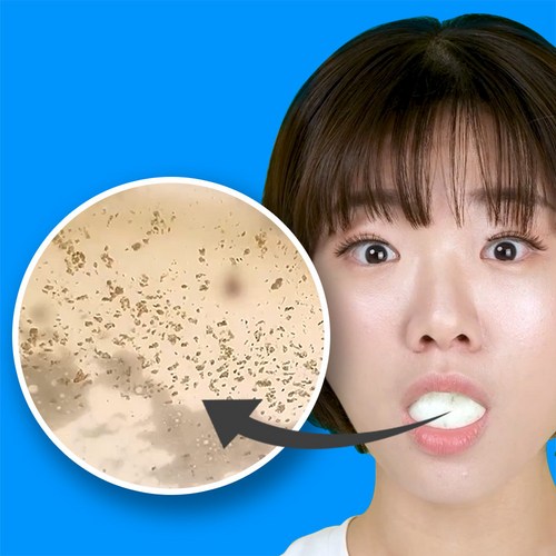 베이킹소다무알콜가글